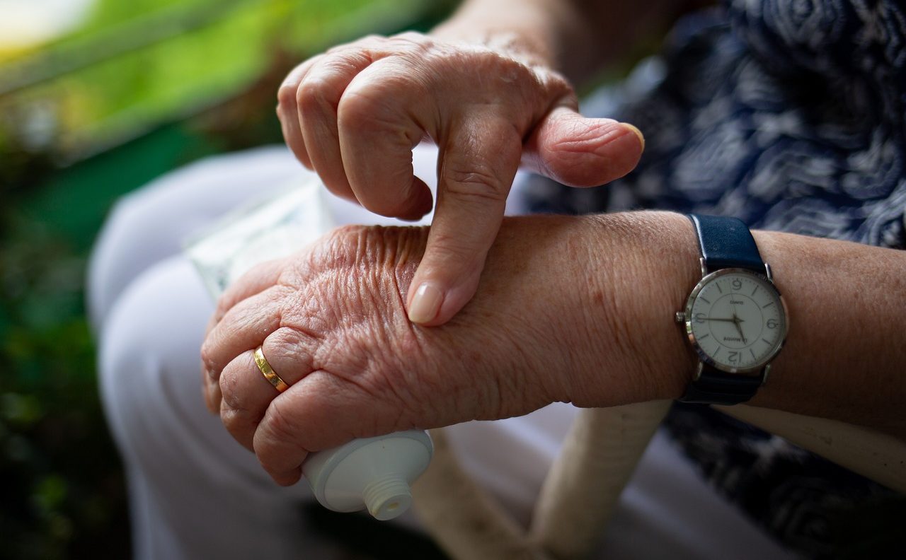 elder with arthritis in hands